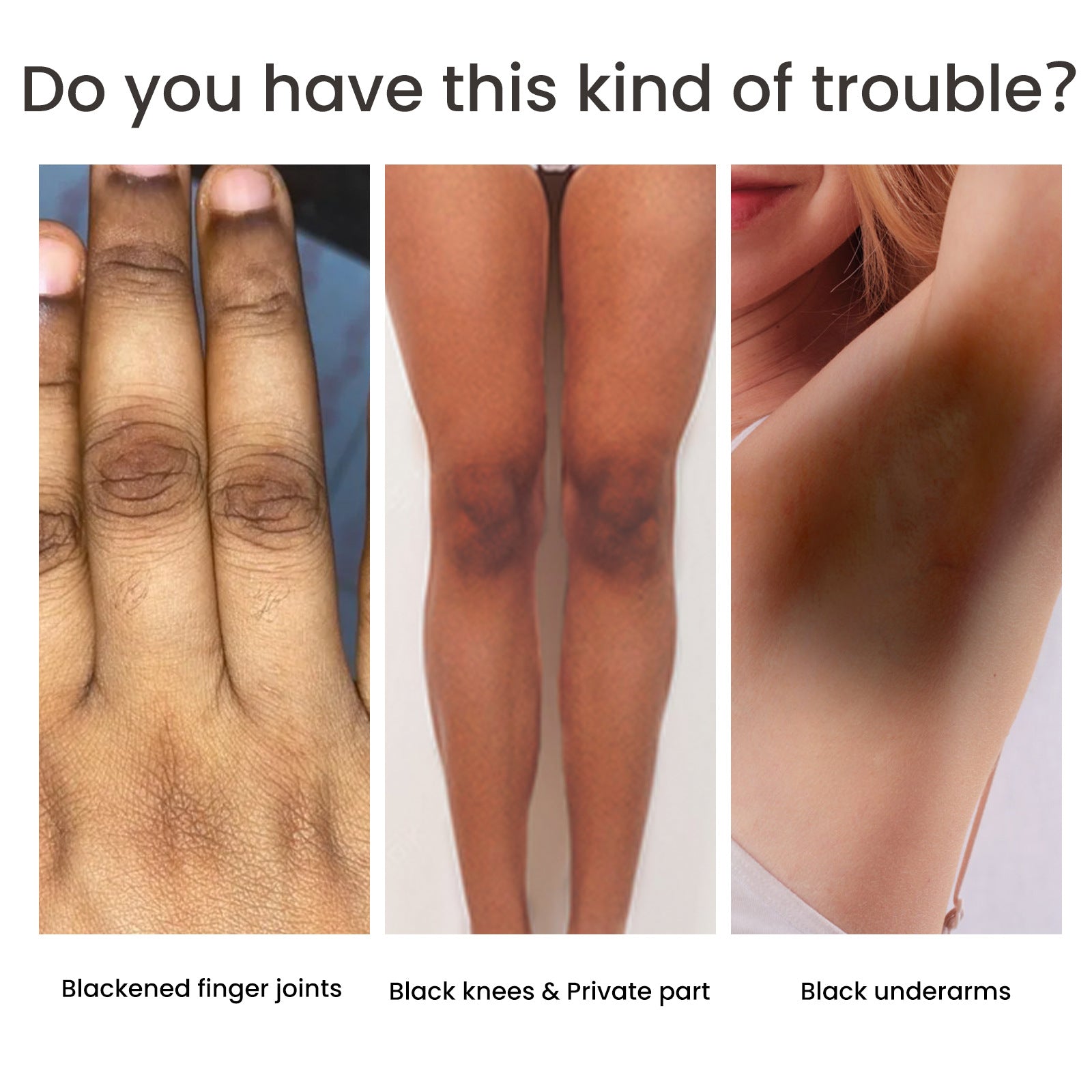 Soins de la pigmentation de la peau chez la femme