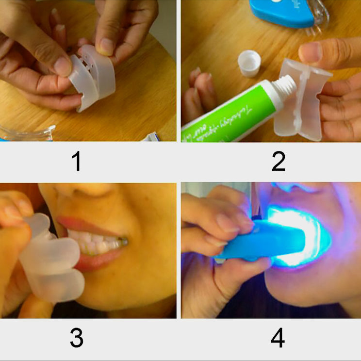 Gel buccal pour le blanchiment des dents, blanchiment dentaire par LED