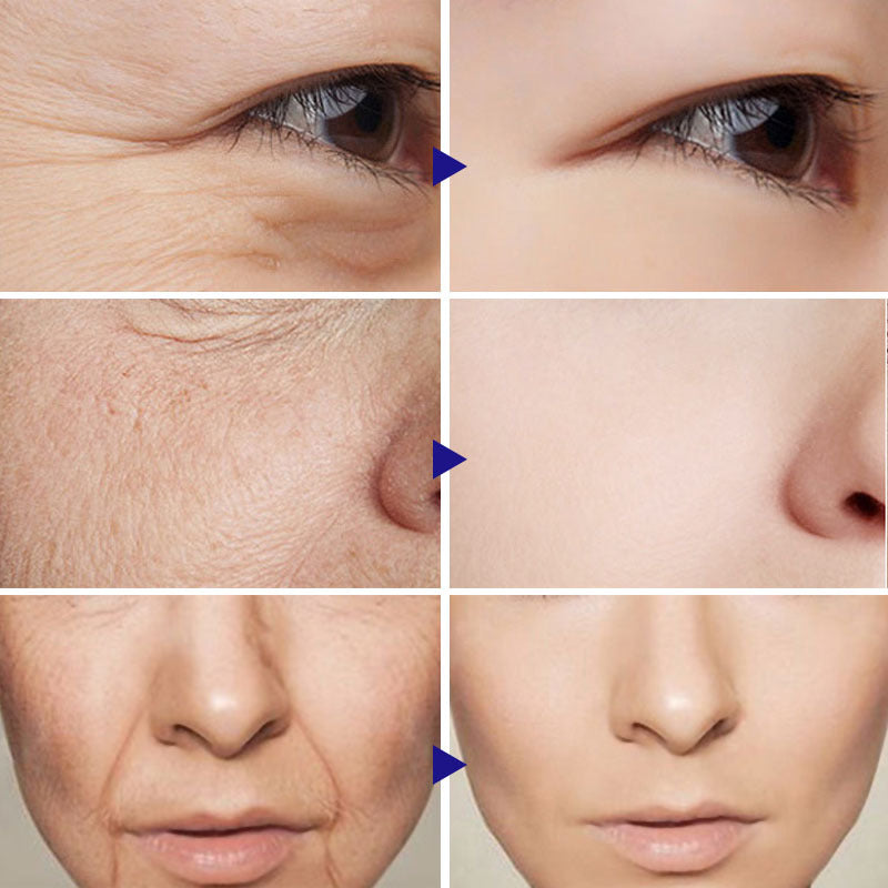 Sérum facial à la Vitamine C – Soin éclat et anti-âge